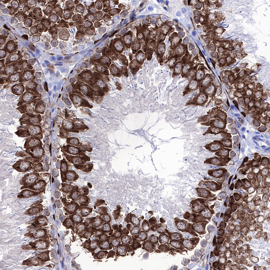 Rabbit anti-Stathmin 1 Recombinant Monoclonal Antibody(383-4)