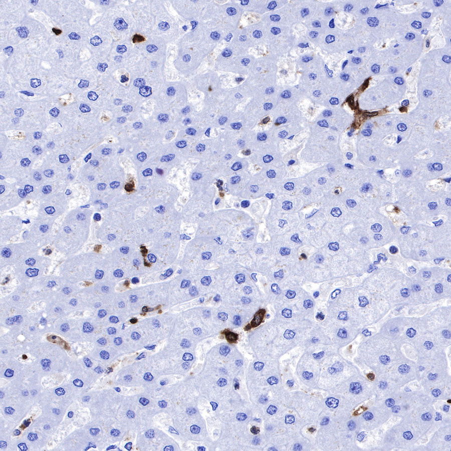 Rabbit anti-Stathmin 1 Recombinant Monoclonal Antibody(383-4)
