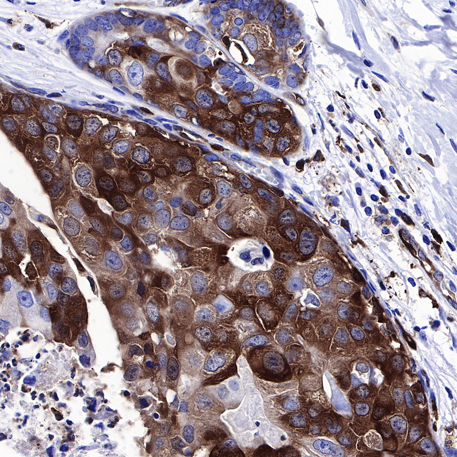Rabbit anti-Stathmin 1 Recombinant Monoclonal Antibody(383-4)