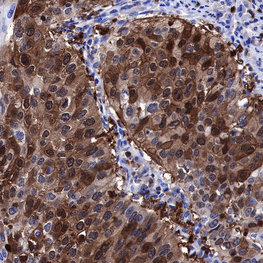 Rabbit anti-Stathmin 1 Recombinant Monoclonal Antibody(383-4)