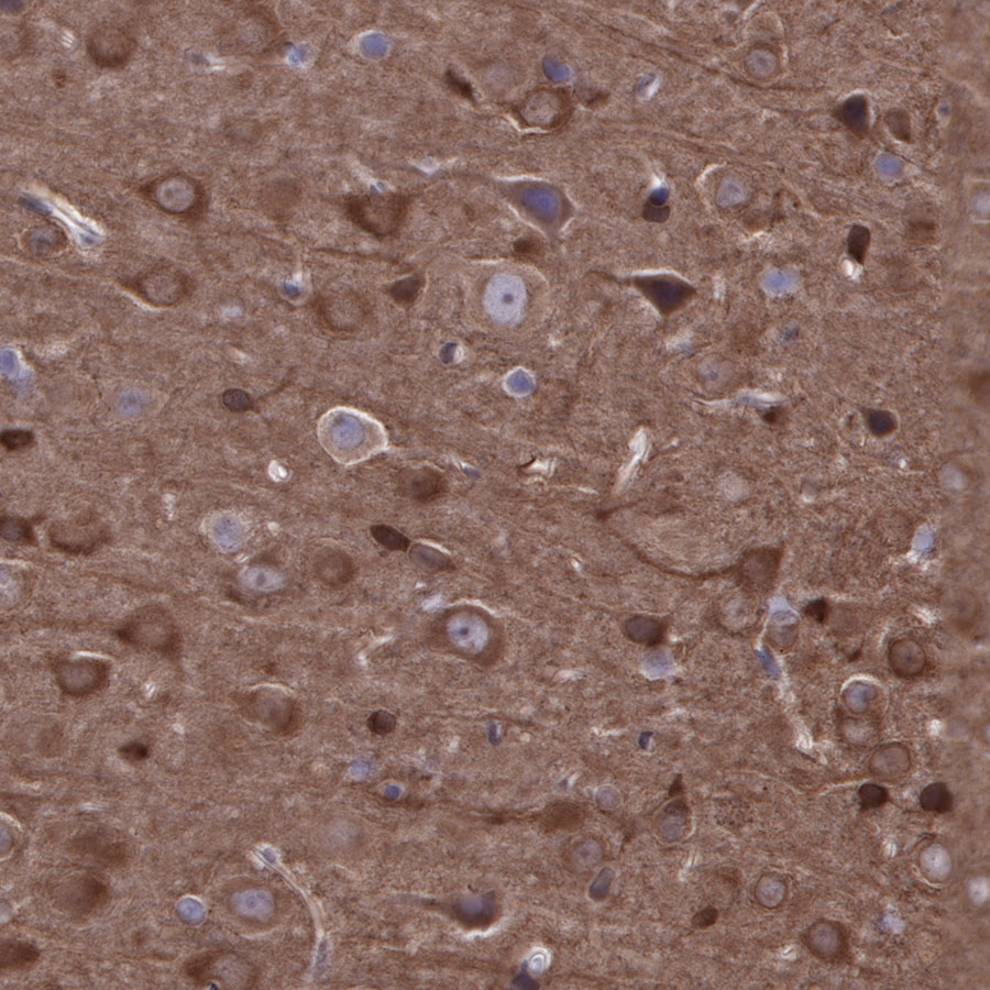 Rabbit anti-Stathmin 1 Recombinant Monoclonal Antibody(383-4)