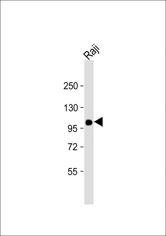 Mouse anti-VAV1 Monoclonal Antibody(1582CT802.383.58)