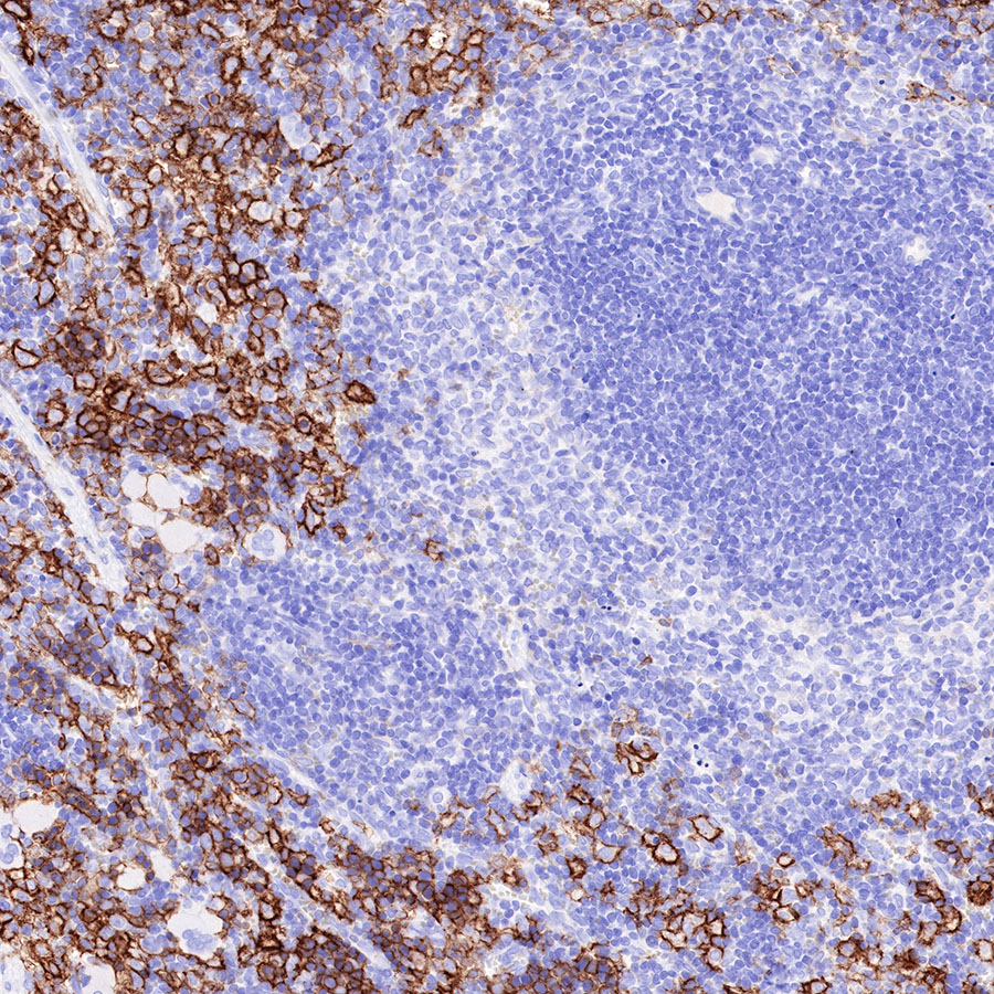 Rabbit anti-CD16a Recombinant Monoclonal Antibody(366-45)