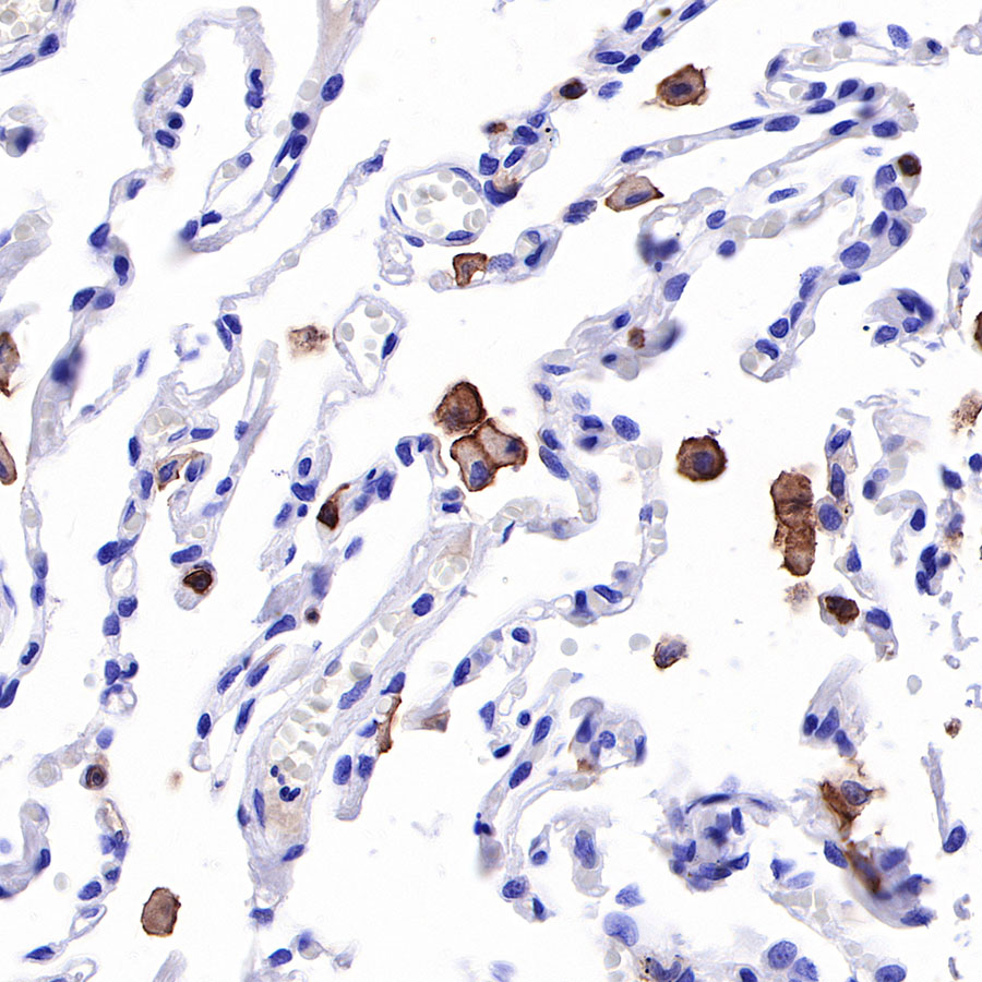 Rabbit anti-CD16a Recombinant Monoclonal Antibody(366-45)