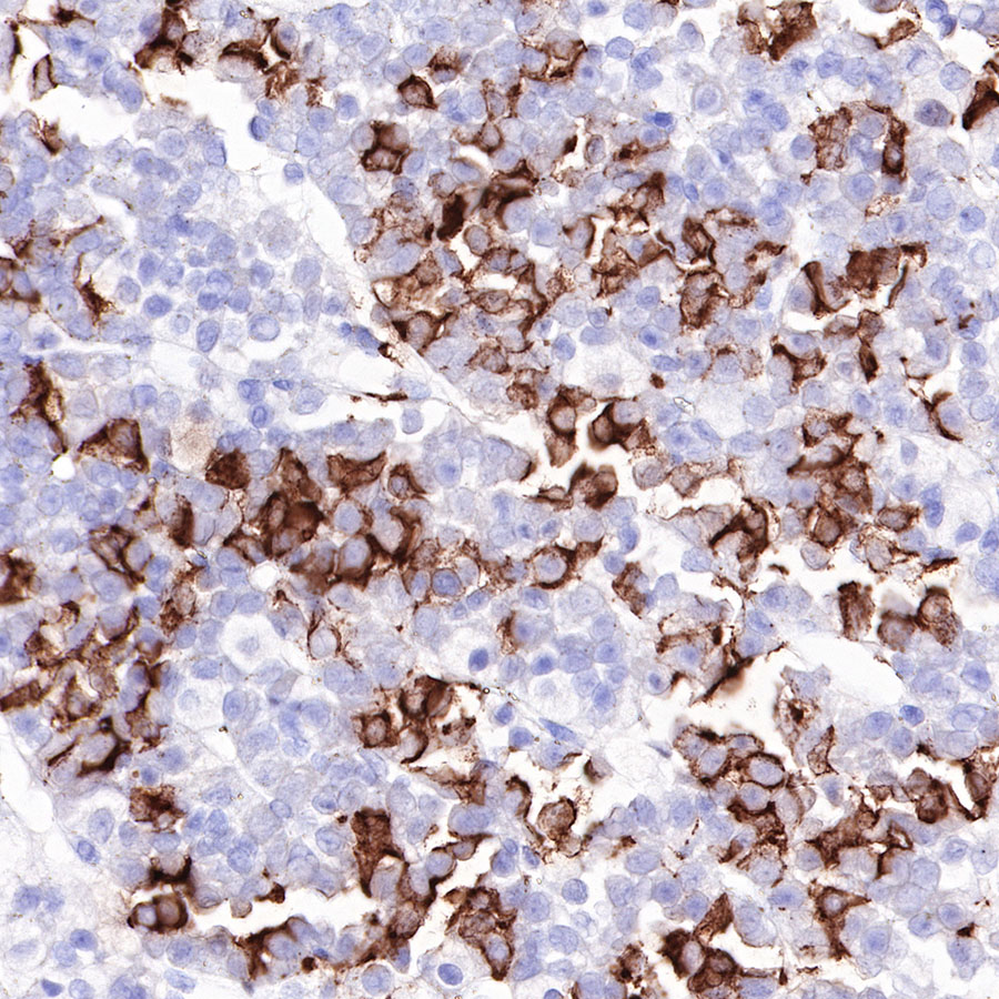 Rabbit anti-ACTH Recombinant Monoclonal Antibody(363-60)