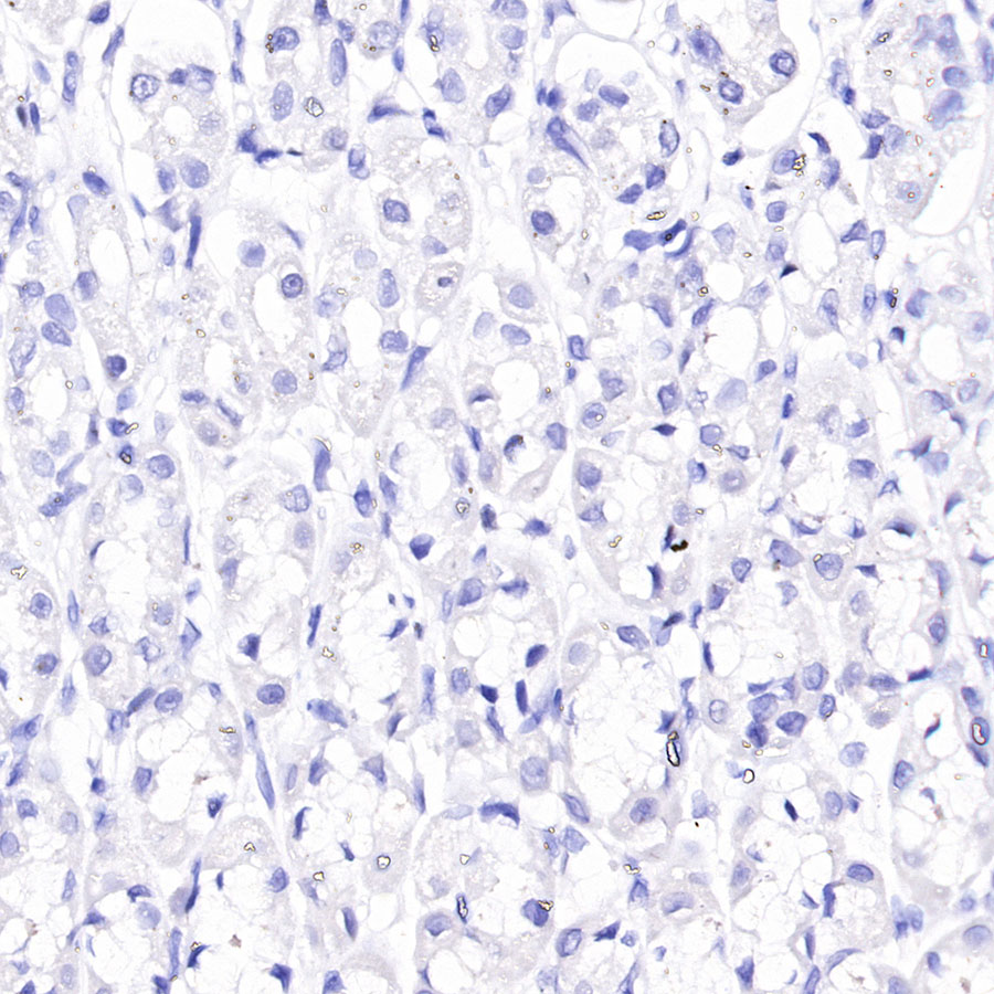 Rabbit anti-ACTH Recombinant Monoclonal Antibody(363-60)