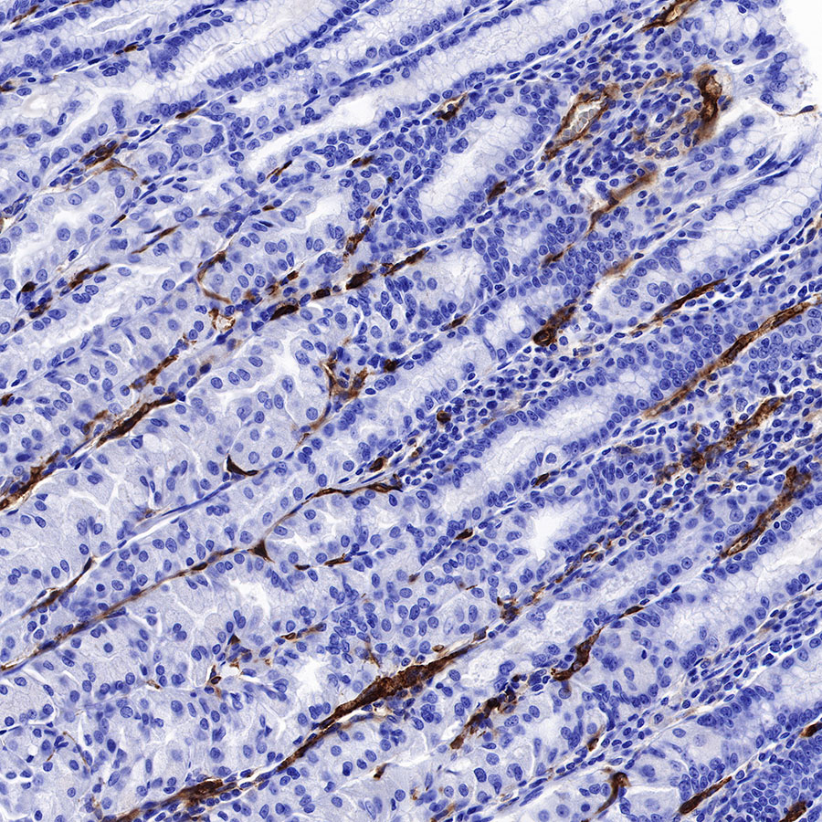 Rabbit anti-CD36 Recombinant Monoclonal Antibody(358-19)