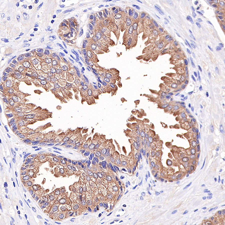 Rabbit anti-PAP Recombinant Monoclonal Antibody(354-18)