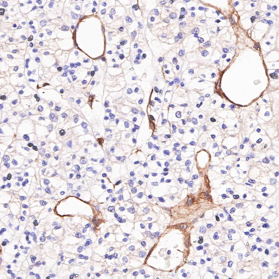 Rabbit anti-CD146 Recombinant Monoclonal Antibody(348-6)