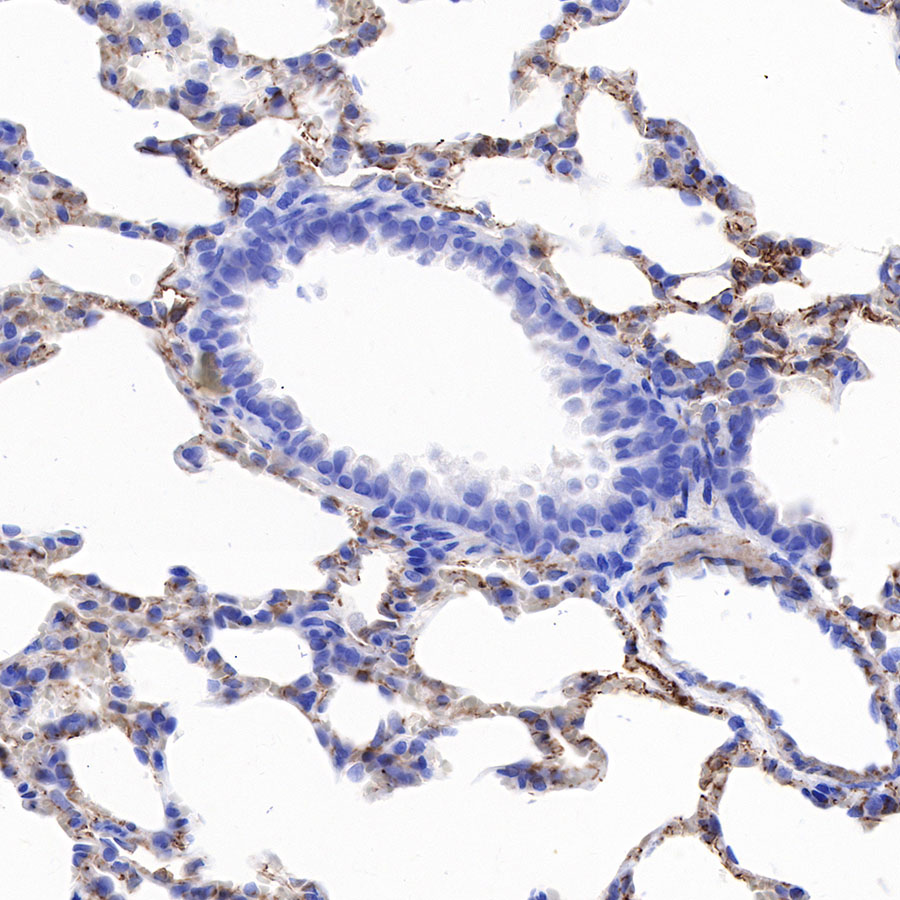 Rabbit anti-CD146 Recombinant Monoclonal Antibody(348-6)