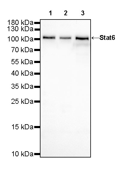 Rabbit anti-Stat6 Recombinant Monoclonal Antibody(337-32)