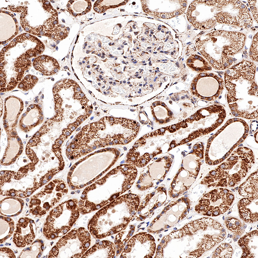 Rabbit anti-Stat6 Recombinant Monoclonal Antibody(337-32)