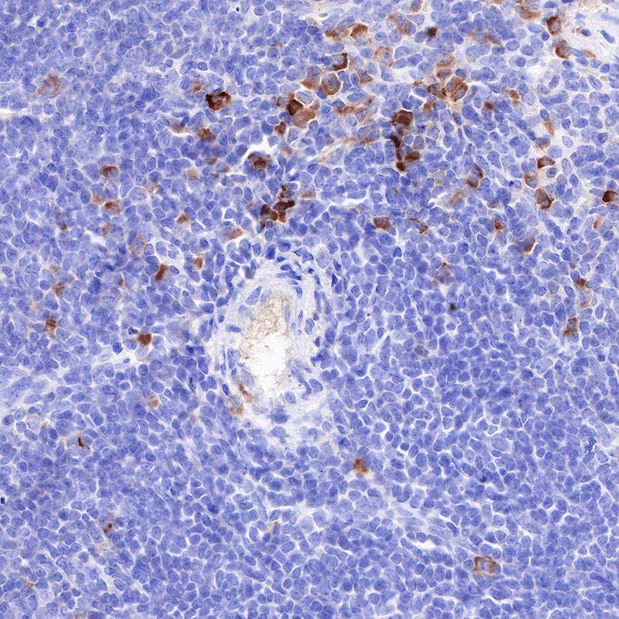 Rabbit anti-CD163 Recombinant Monoclonal Antibody(327-58)