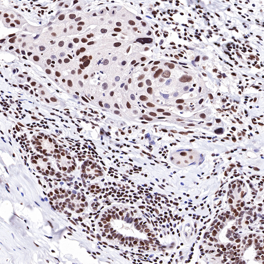 Rabbit anti-HDAC1 Recombinant Monoclonal Antibody(310-72)