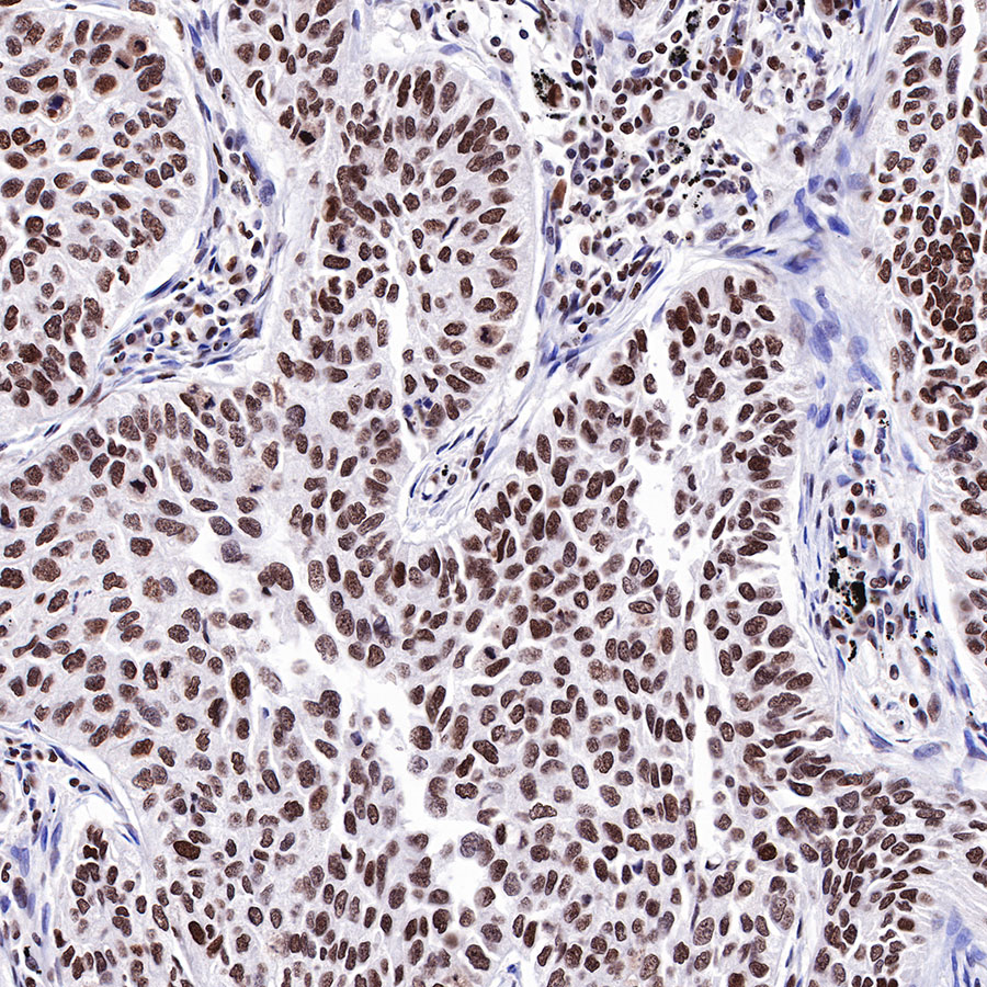 Rabbit anti-HDAC1 Recombinant Monoclonal Antibody(310-72)