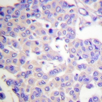 Rabbit anti-Synaptotagmin(pS309/306) Polyclonal Antibody