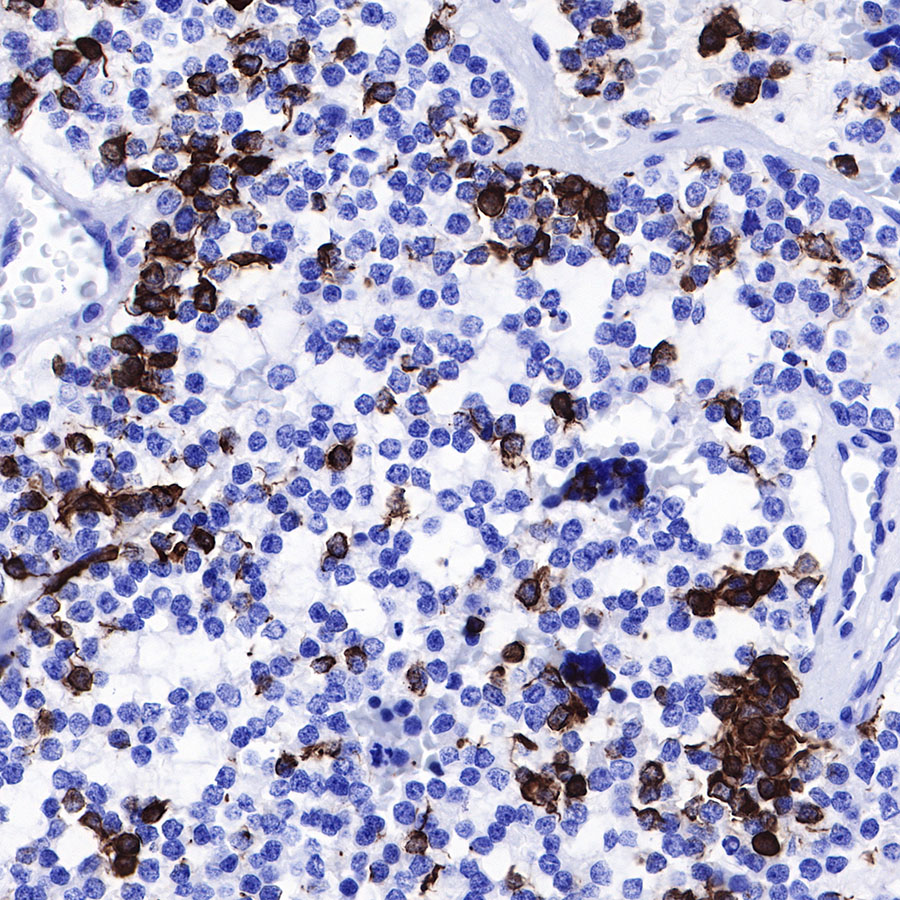 Rabbit anti-GFAP Recombinant Monoclonal Antibody(306-10)
