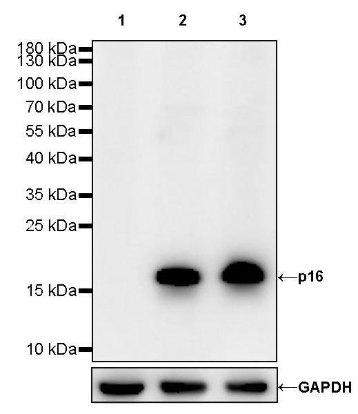 Rabbit anti-p16 Recombinant Monoclonal Antibody(S-303-1)