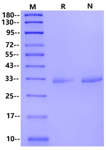 Recombinant Human MSLN/Mesothelin(37-286) Protein(His Tag)