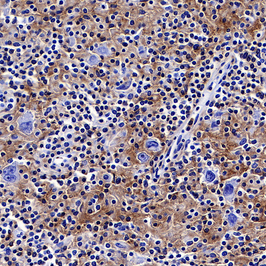 Rabbit anti-LAIR1 Recombinant Monoclonal Antibody(S-285-2)