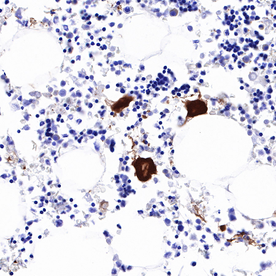 Rabbit anti-CD226 Recombinant Monoclonal Antibody(284-30)