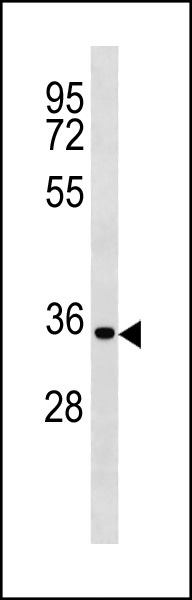 Rabbit anti-CCND2 Polyclonal Antibody(C-term S279/T280)