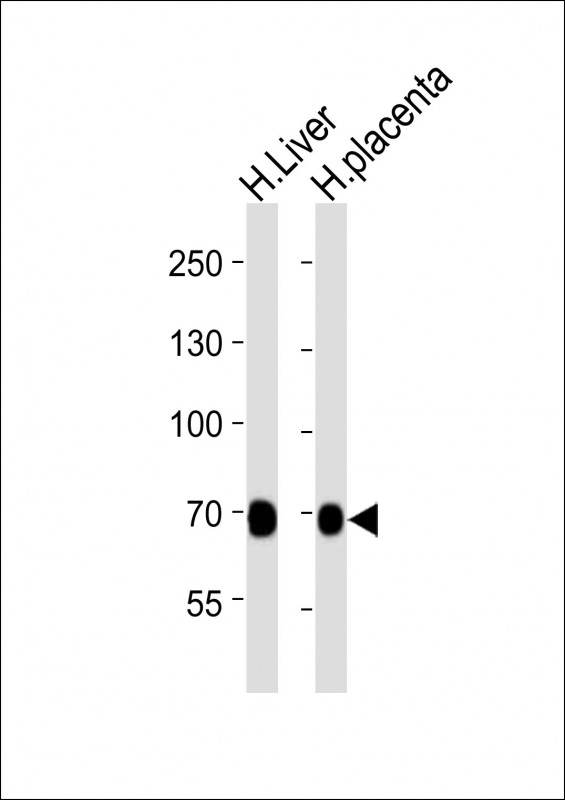 Mouse anti-FLT1 Monoclonal Antibody(1453CT519.277.79)