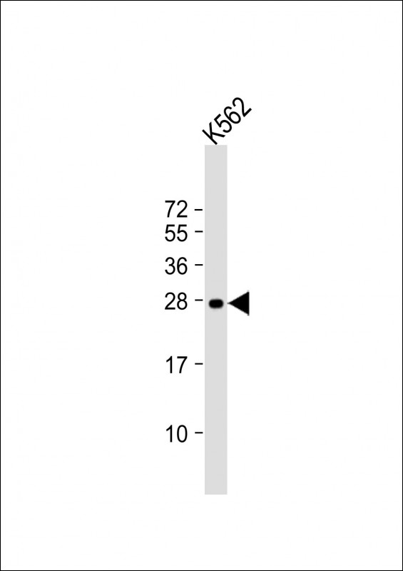 Mouse anti-RAB27A Monoclonal Antibody(1590CT813.266.26)