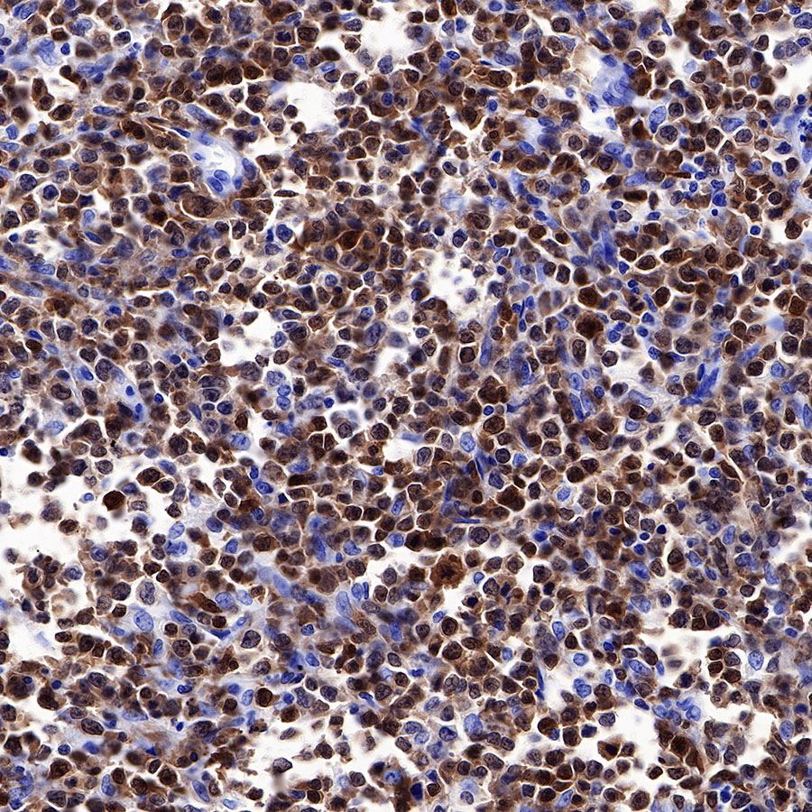 Rabbit anti-BOB-1 Recombinant Monoclonal Antibody(263-55)