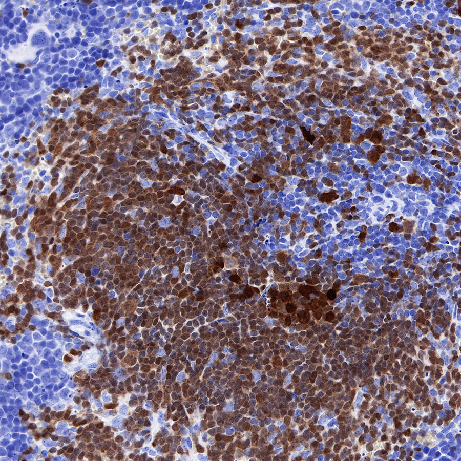 Rabbit anti-BOB-1 Recombinant Monoclonal Antibody(263-55)