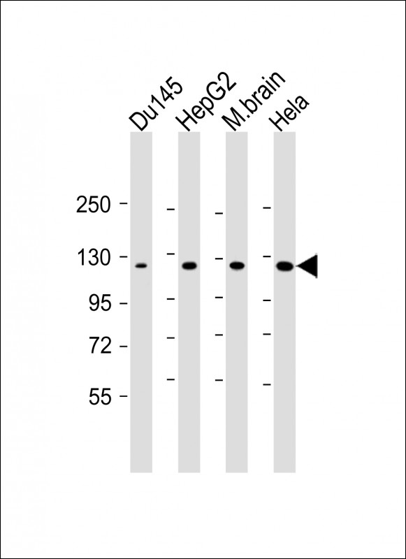 Mouse anti-DAB2IP Monoclonal Antibody(1626CT702.263.21)