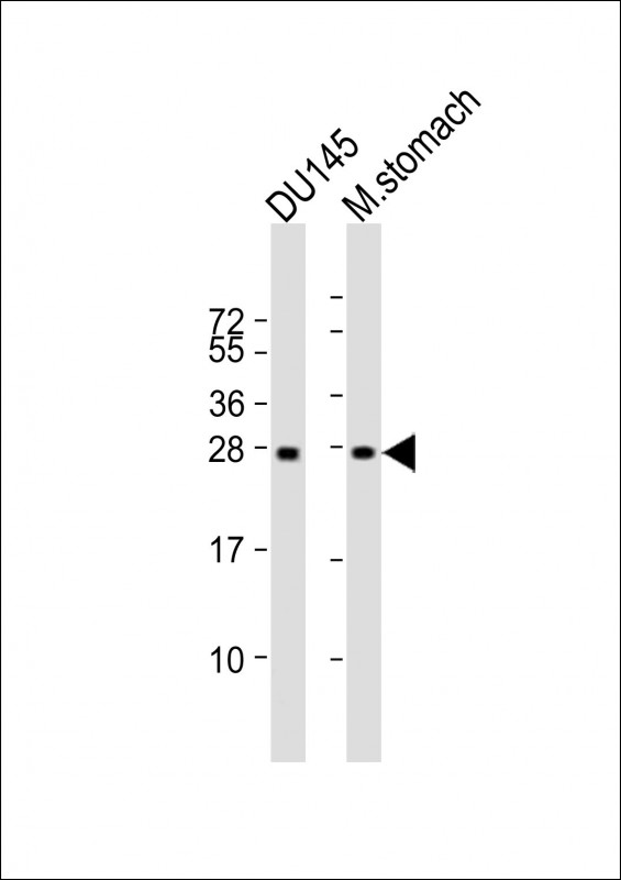Mouse anti-RAB27B Monoclonal Antibody(1596CT245.254.49)
