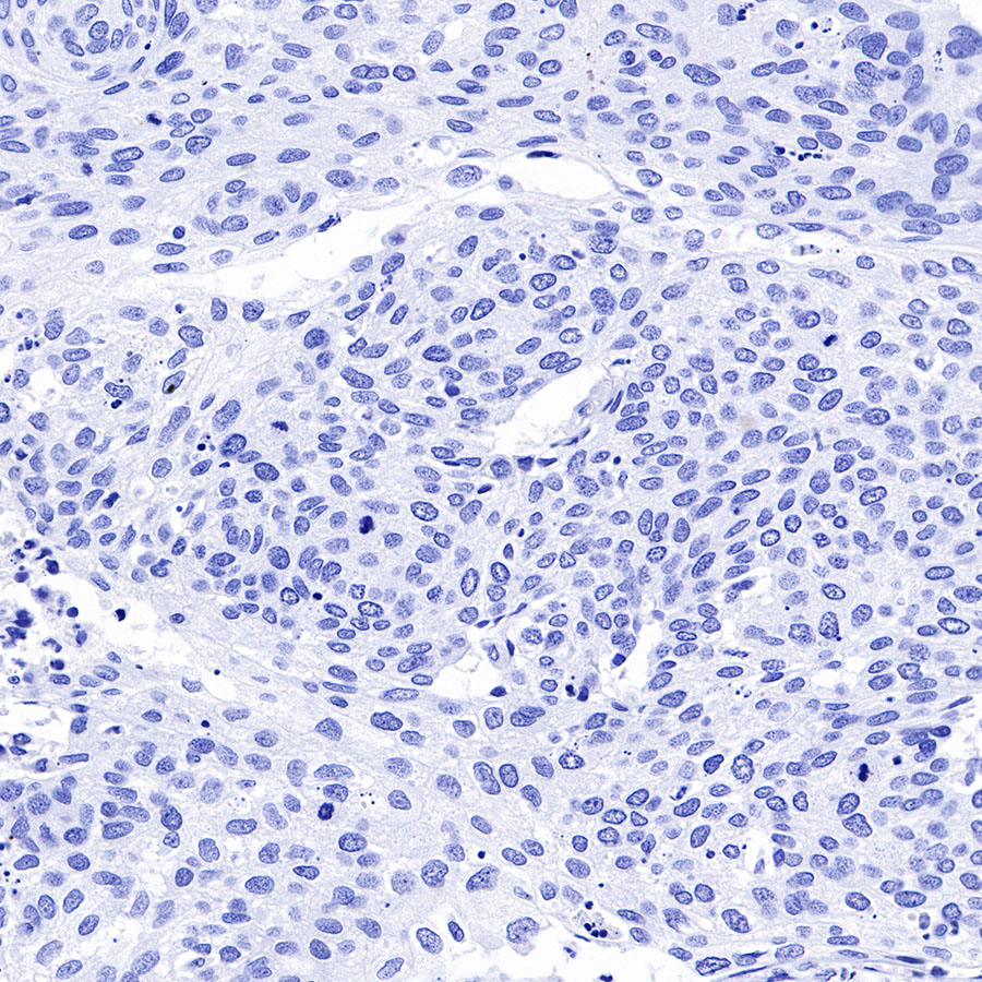 Rabbit anti-GPA33 Recombinant Monoclonal Antibody(248-76)