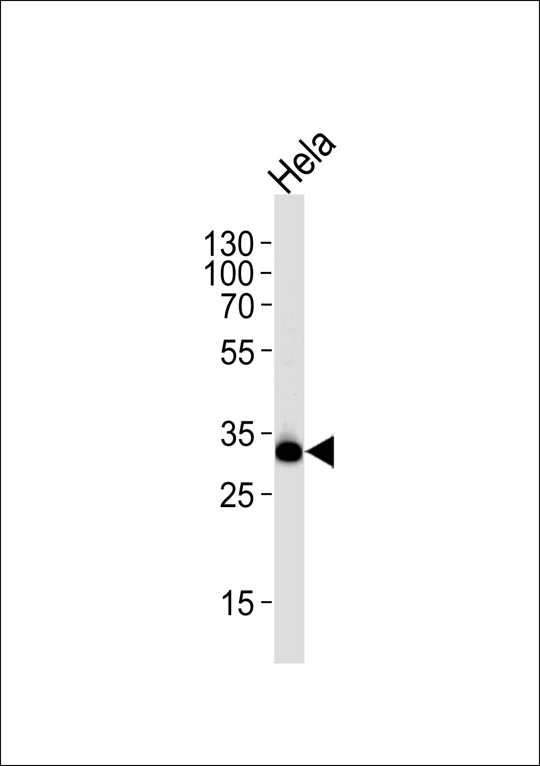 Rabbit anti-RPS6 Polyclonal Antibody(Ser240/244)