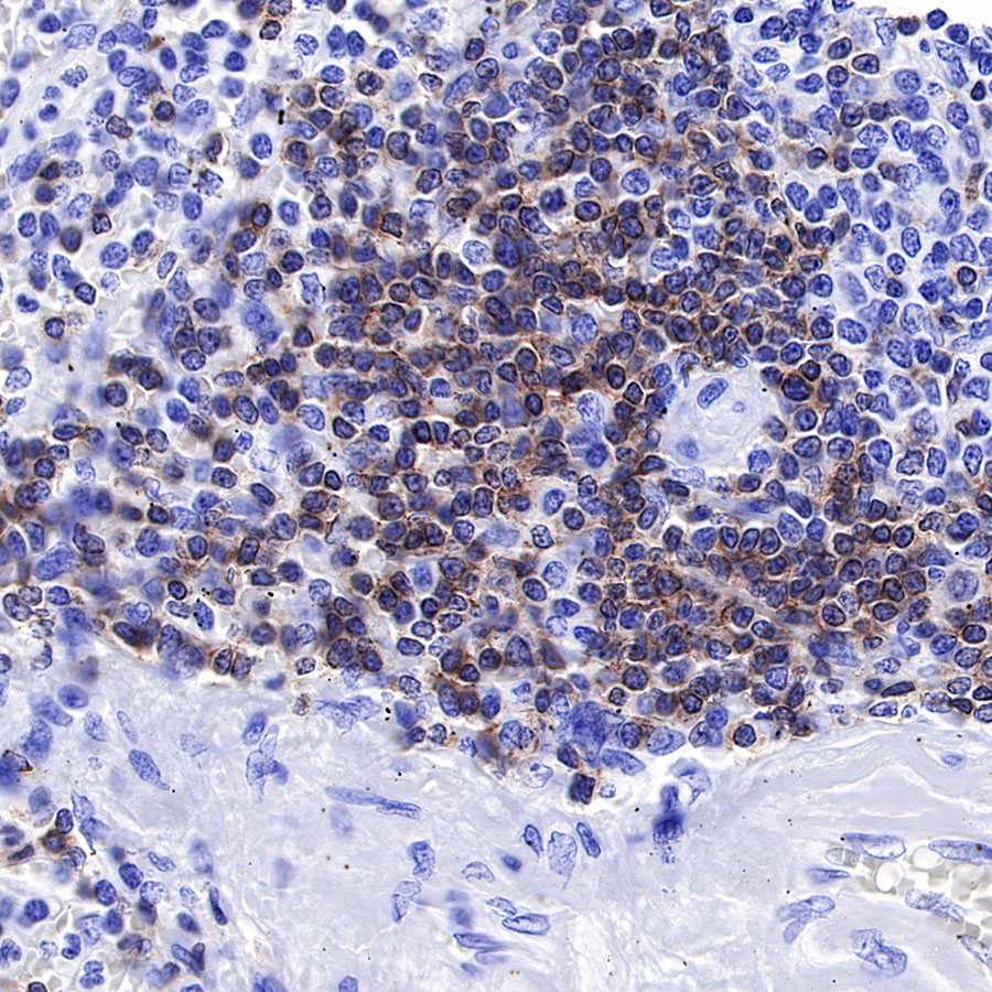 Rabbit anti-CD3 epsilon Recombinant Monoclonal Antibody(241-49)