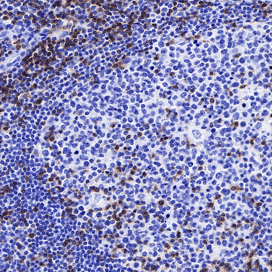 Rabbit anti-CD3 epsilon Recombinant Monoclonal Antibody(241-49)