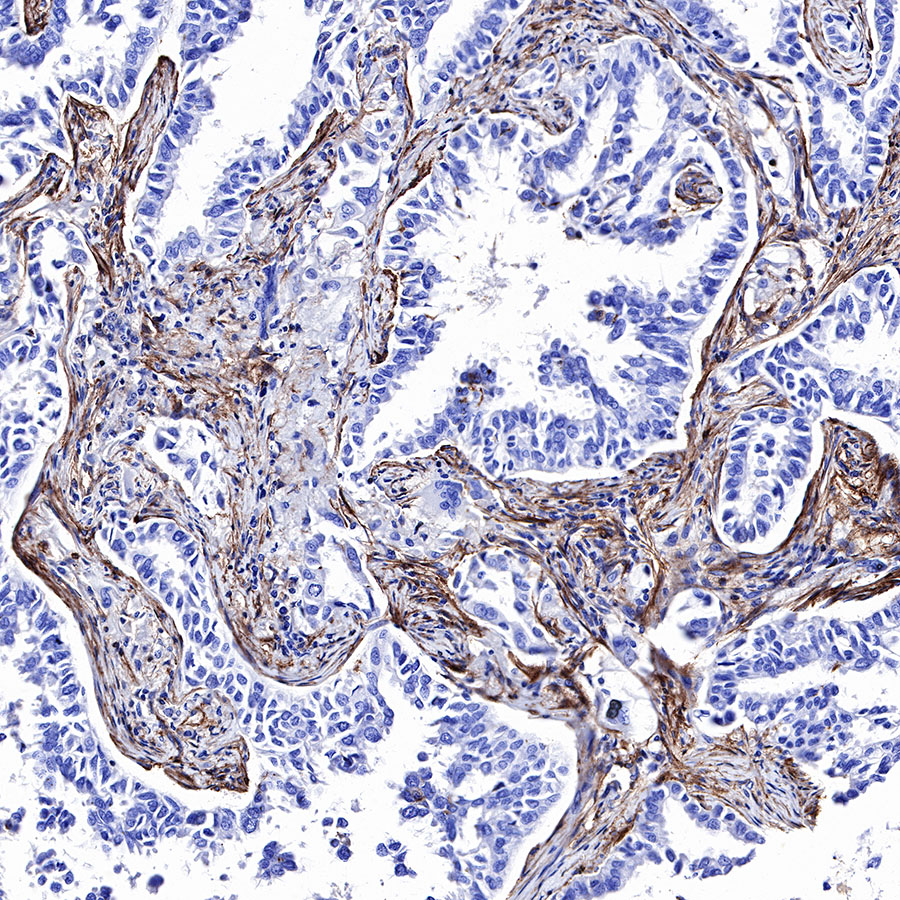 Rabbit anti-CD39 Recombinant Monoclonal Antibody(236-20)