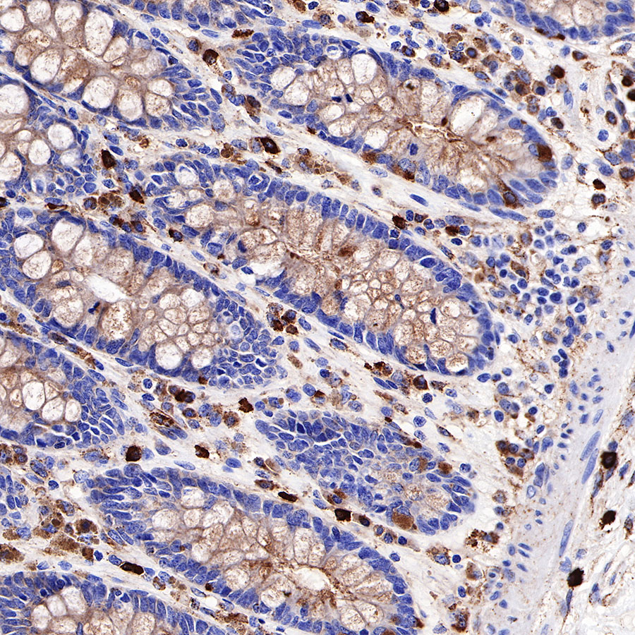 Rabbit anti-CD63 Recombinant Monoclonal Antibody(230-3)