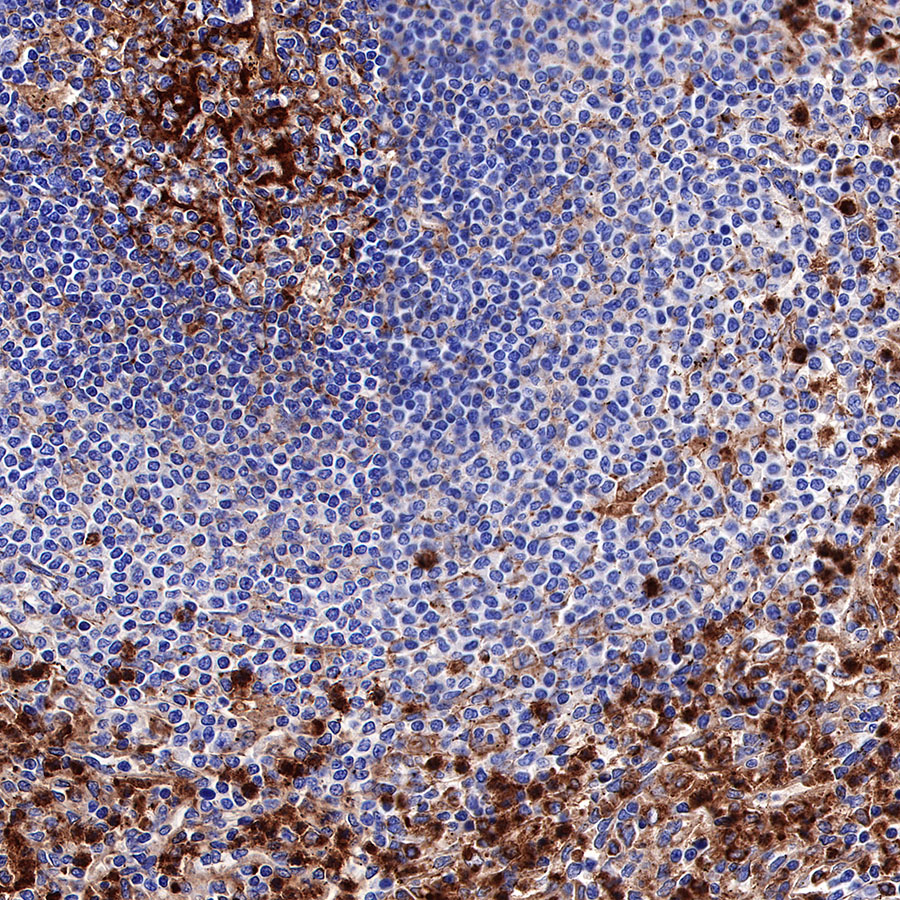 Rabbit anti-CD63 Recombinant Monoclonal Antibody(230-3)