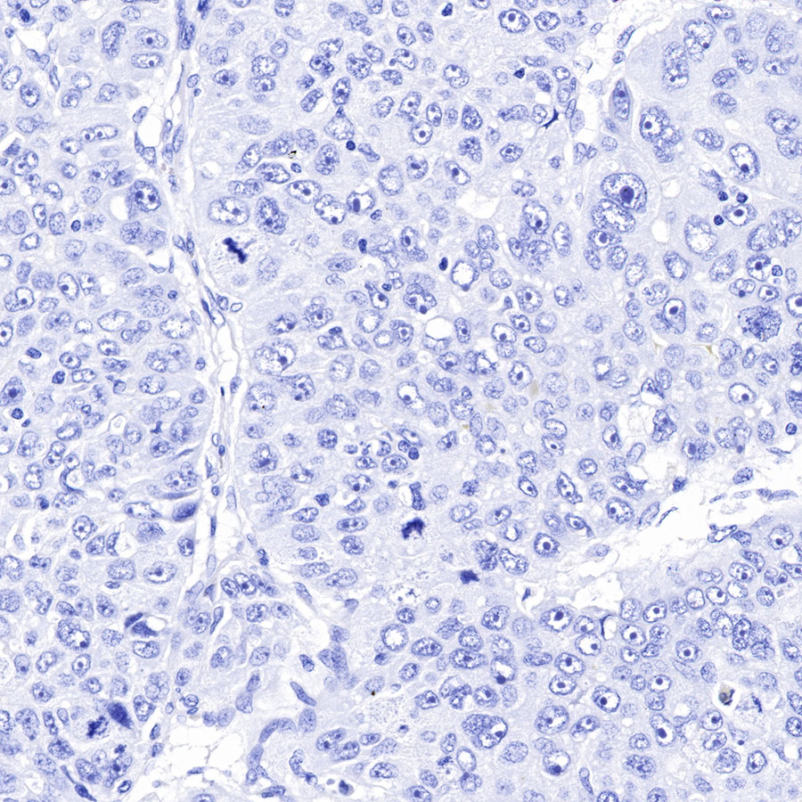 Rabbit anti-PAPP-A Recombinant Monoclonal Antibody(226-46)