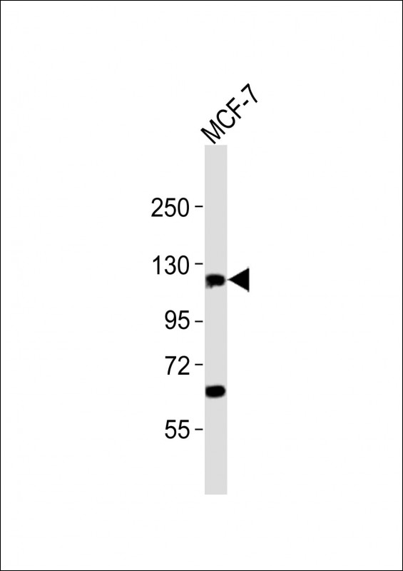 Rabbit anti-ZNF217 Polyclonal Antibody(N-term)
