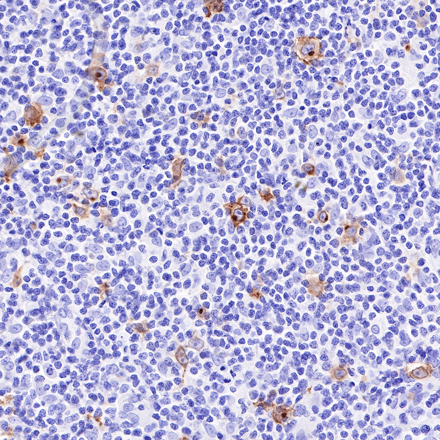 Rabbit anti-CD30 Recombinant Monoclonal Antibody(216-2)