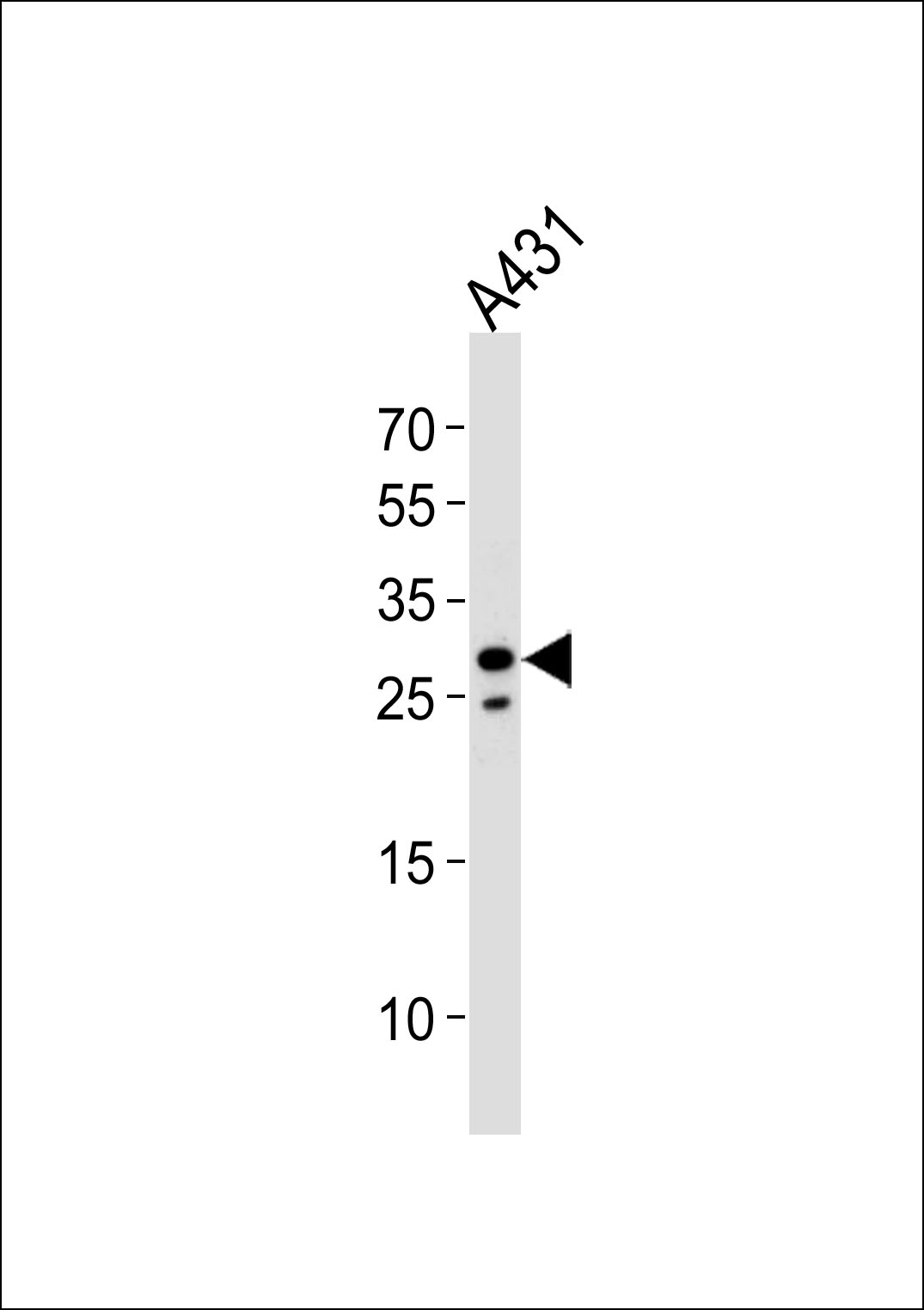 Rabbit anti-RNF208 Polyclonal Antibody(Center)