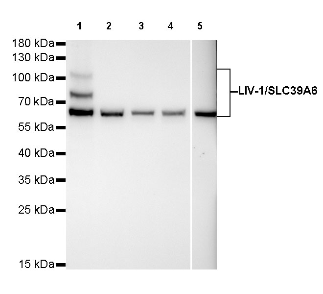 Rabbit anti-LIV-1/SLC39A6 Recombinant Monoclonal Antibody(206-8224)