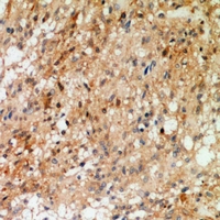 Rabbit anti-Synaptotagmin(pT202/199) Polyclonal Antibody