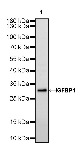 Rabbit anti-IGFBP1 Recombinant Monoclonal Antibody(196-47)