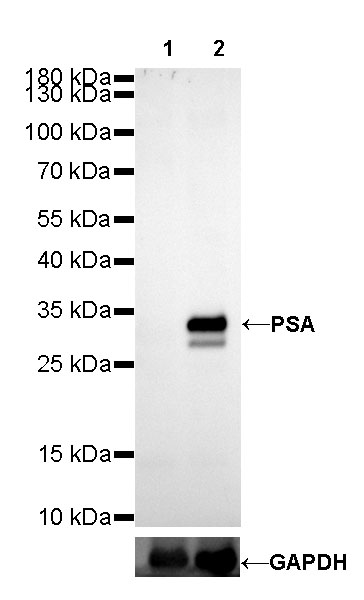 Rabbit anti-PSA Recombinant Monoclonal Antibody(195-14)
