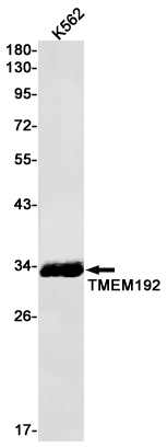 Rabbit anti-Transmembrane Protein 192 Monoclonal Antibody(4J4)