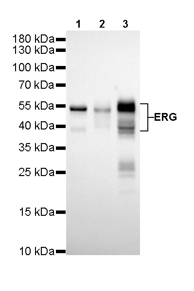 Rabbit anti-ERG Recombinant Monoclonal Antibody(190-65)