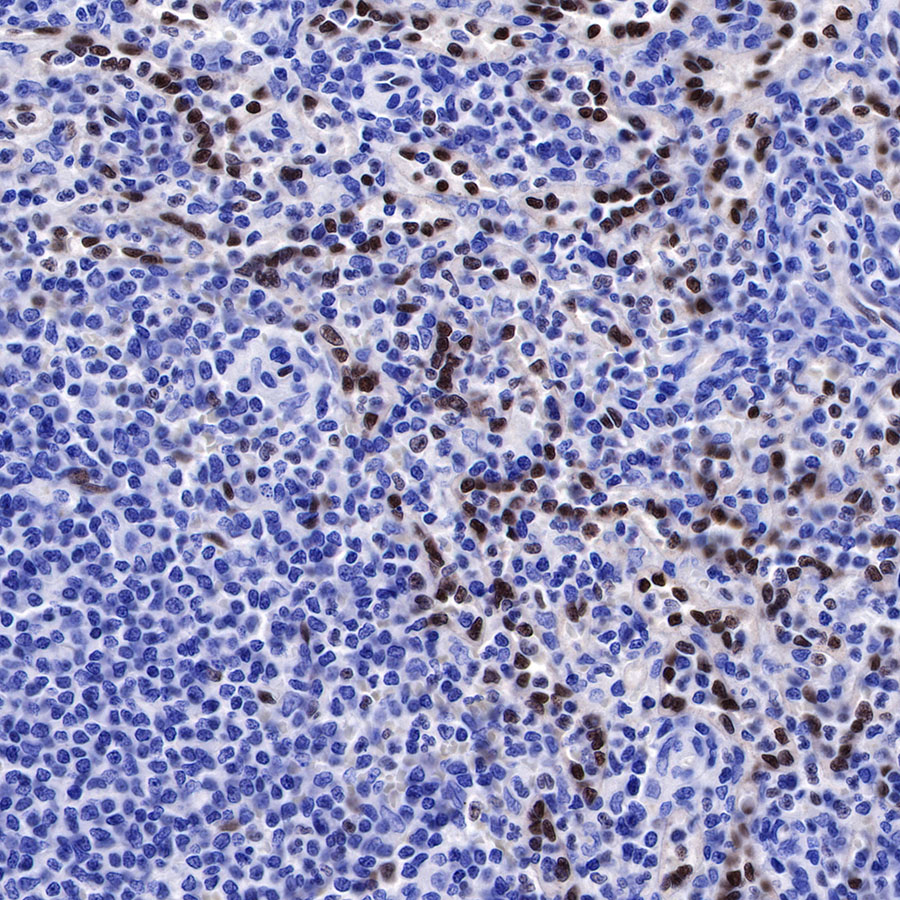 Rabbit anti-ERG Recombinant Monoclonal Antibody(190-65)